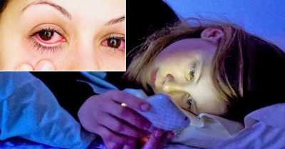 Esto te sorprenderá, una persona le diagnosticaron cáncer a los ojos, solo por hacer esto a oscuras ¡tú no lo hagas¡