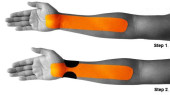0-1286_1110_7_general_wrist_pain